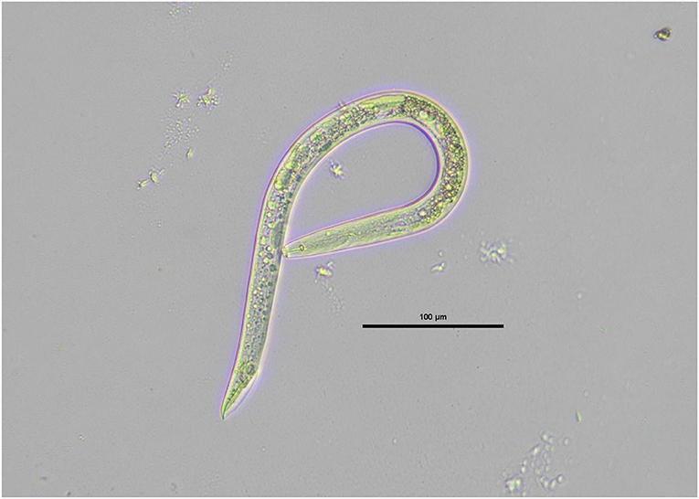 Figure 1. A male root-eating nematode of the Pratylenchus species, collected from carrot roots. For scale, 100 μm is 10 times smaller than 1 mm and is roughly the width of a human hair!