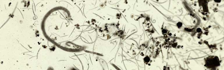 UF researchers identify crop-destroying nematodes with AI